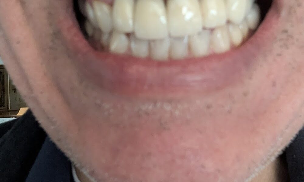 Friendly Dental Care