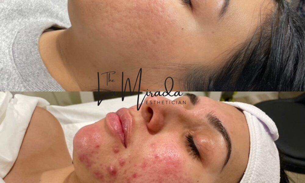 The La Mirada Esthetician – Facials + Brazilian Sugaring