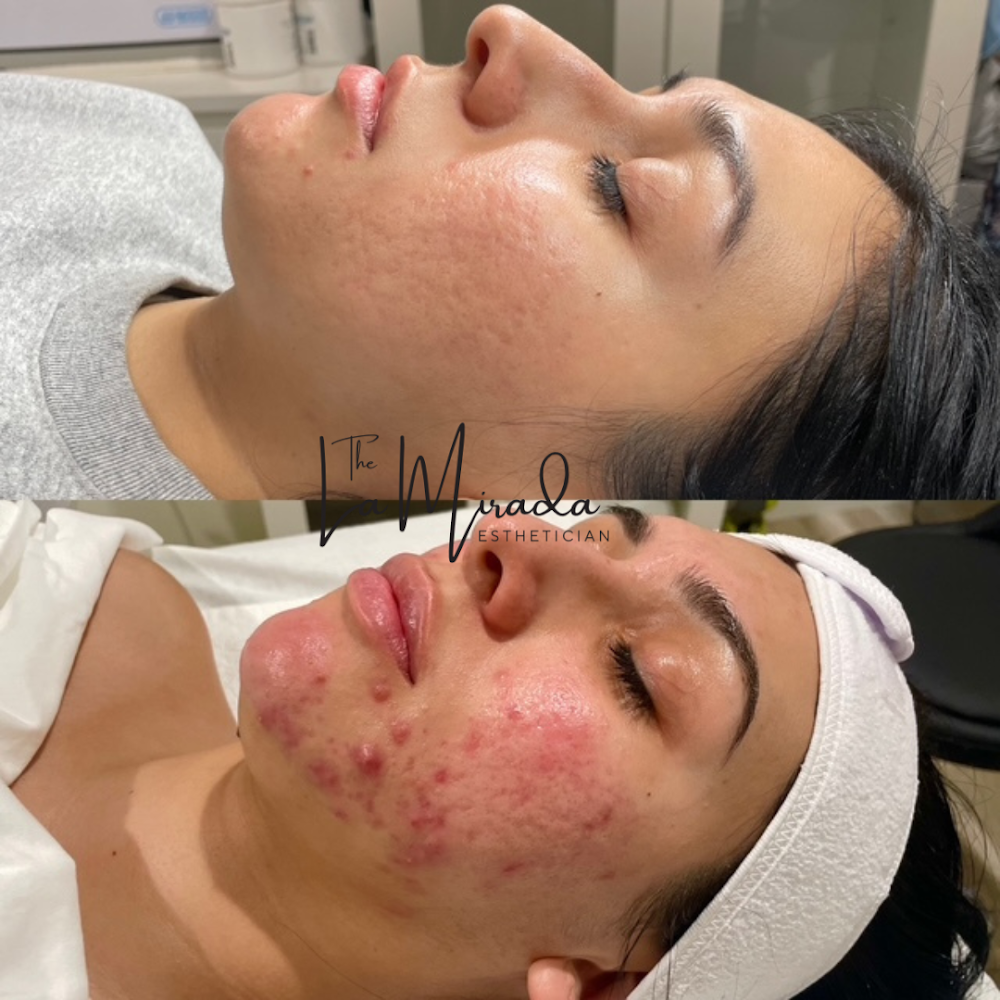 The La Mirada Esthetician – Facials + Brazilian Sugaring